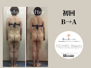 エスエスカイロビューティー(SSCHIRO beauty)/美骨ボディ1部位〔美脚〕初回BA