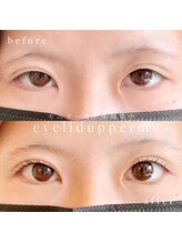 アプレ(APPELER)/アイリッドアップパーマ