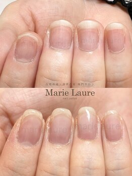 マリーロール 淀屋橋本店(Marie Laure)/自爪育成/深爪矯正/ネイルケア