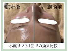 ルーセントの雰囲気（【小顔・リフトアップ】施術直後から即変化を実感！）