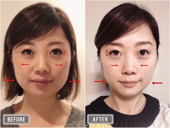 さつま骨格矯正 表参道青山院/歪み小顔矯正＋骨盤矯正