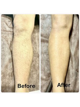 シーズン(Season)/シュガーリング