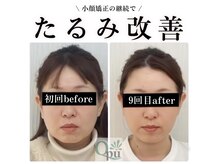 キュープ 奈良天理店(Qpu)