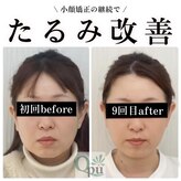 キュープ 奈良天理店(Qpu)