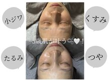 肌質改善専門Salon72 【ハーブピーリング/毛穴/シミ/たるみ/ニキビ改善】の雰囲気（即効性があり結果重視のサロンです☆）