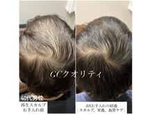ジャンティーシャトー 助信店(Gentil Chateau)の雰囲気（エビデンスマシン×ハイグレード製剤×GCメソッドで結果提供）