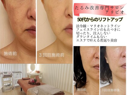 アリビオ(alivio)の写真