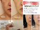アリビオ(alivio)の写真