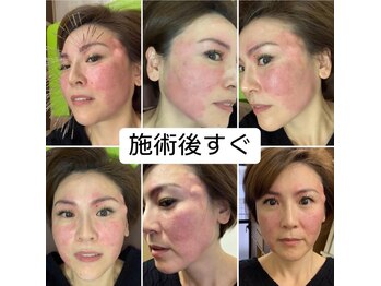 ランスソア(L'ins soi)/