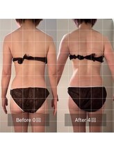 フィエルテ 甲斐敷島(FIERTE)/before after