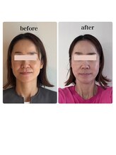 かぐや(salon)/ビフォーアフターのお写真