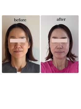 かぐや(salon)/ビフォーアフターのお写真