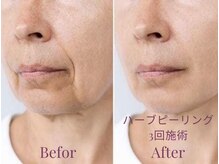 フィオーレ(Fiore)