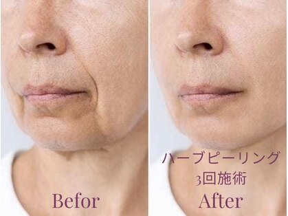 フィオーレ(Fiore)の写真