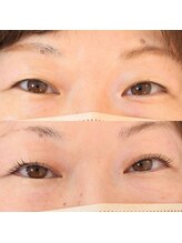 プライベイトスペース コト(PRIVATE SPACE COTO)/ダブルアイリフト