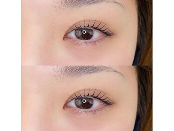 アーラ(ala)/美容液+ラッシュリフト