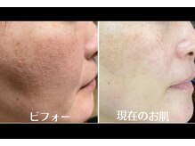 サロンドミジュ(Salon de 美jyu)/プラチナ肌質改善