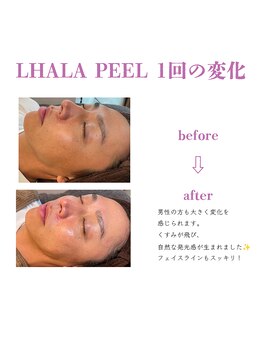 ベル(BELL)/男性も大歓迎・美肌で若々しく