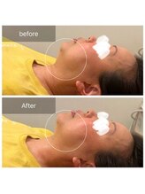 ウィズ ユー ビューティ(with U beauty)/浮腫たるみケア