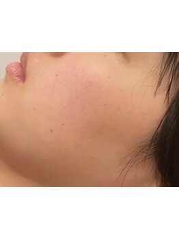 1回ごとにお支払い可能なサロン