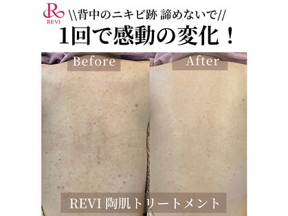 癒える(ielu)の写真