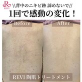 癒える(ielu)