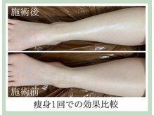 ルーセントの雰囲気（【痩身・脚お尻メニュー】足首・ふくらはぎのシュッと感を即実感）