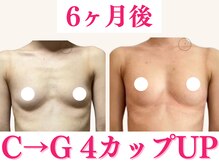 エクラパピヨン 荻窪(Eclatpapillon)の雰囲気（6ヶ月で4カップUP!まるで別人のバスト/育乳）