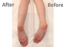 アリー(Alii)/むくみ＋O脚X脚に！