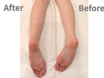 アリー(Alii)/むくみ＋O脚X脚に！