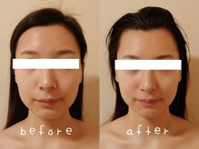 ホワイトサロンファミリア(whitesalon familia)/小顔コルギ＋毛穴洗浄＋美容液