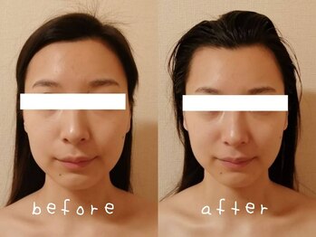 ホワイトサロンファミリア(whitesalon familia)/小顔コルギ+毛穴洗浄+美容液