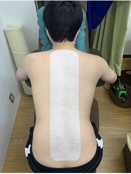 高田馬場名倉堂鍼灸接骨院/テーピングです
