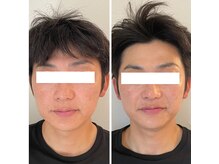 サロンニコ(salon Nico)の雰囲気（男性コルギ/メンズ小顔/エイジング/透明感/ヘッドスパ/髭脱毛）