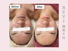 ルア(LuA.)/くすみのない肌に♪