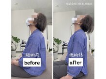 由利本荘整体院/施術ビフォーアフター（首）