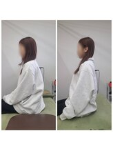 整骨院がじゅまる堂/[姿勢矯正] before/after