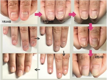 クウ(KUU)/深爪→美爪