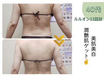 ヨサパーク ミミ 高野店(YOSA PARK mimi)/ビフォーアフター