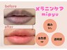 【3名限定★モニター募集】メラニンケア リップ ¥77,000→¥38,500