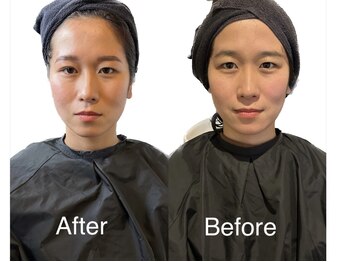 ベレカ(belleca)/骨格補整スパ×HBLで小顔&垢抜け