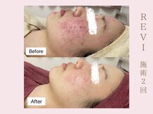 ルア(LuA.)/幹細胞美容◎