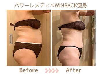 リトリト(Retreat)/ビフォーアフター(半年)