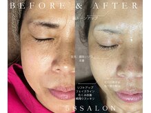 コアサロン(58SALON)の雰囲気（小顔矯正、ハイドラ、ラジオ波で見た目の激変！驚きの効果の実感）