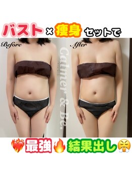 カルマーアンドビー(Calmer & Be.)/【バスト×痩身】Before/After