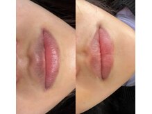 アンフィア(Anfia)/