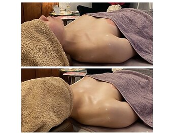 ベンザイ 新潟店(BENZAI)/お肌はくすみ、赤み、巻肩、疲れ