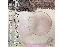 プリュム(Plume)の雰囲気（長年改善しなかった毛穴詰まり、黒ずみを大掃除）