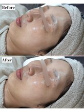 ソワナ(soina)/【神楽坂駅/フェイシャル/毛穴】