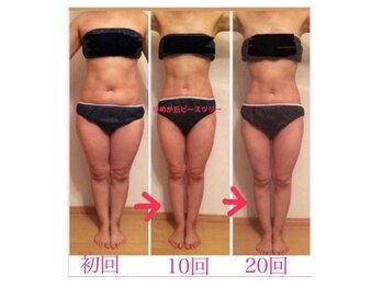 ピースツリー(PEACE TREE)/サロンでのビフォーアフター